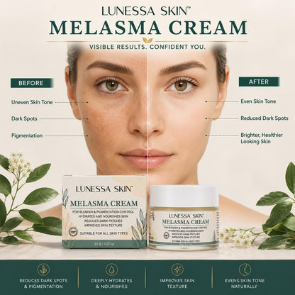 Melasma Cream for Face Dark Spot & Hyperpigmentation Cream Blemish & Pigmentation Control Hydrates & Nourishes Skin Improves Skin Texture 30g